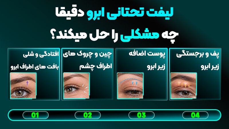 لیفت تحتانی ابرو برای بالا بردن ابرو مناسب است یا رفع پف ابرو؟ 1 لیفت تحتانی ابرو دقیقا چه چالشی را رفع میکند؟