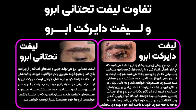 آیا لیفت تحتانی ابرو برای اصلاح فرم خود ابرو انجام میشود؟ 2 لیفت تحتانی ابرو انجام دهم یا لیفت دایرکت ابرو؟