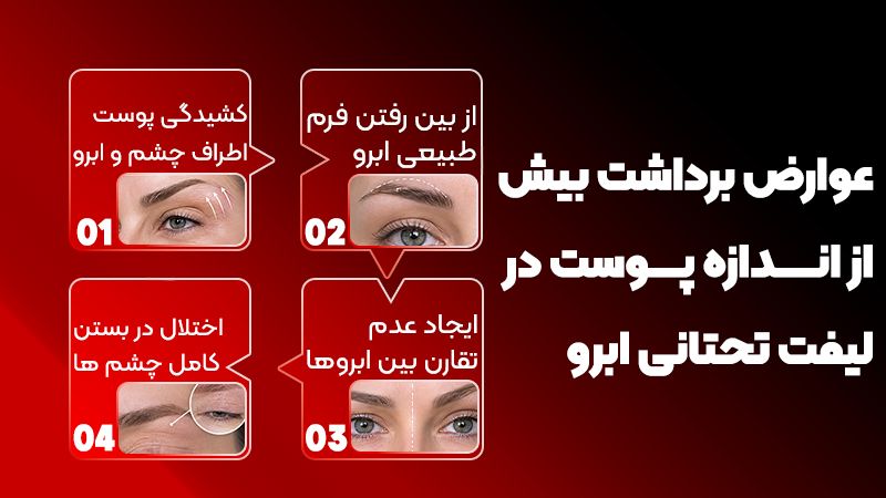 در لیفت تحتانی ابرو چه مقدار از پوست اضافه برداشته میشود؟ 2 عوارض برداشت بیش از اندازه پوست در لیفت تحتانی ابرو