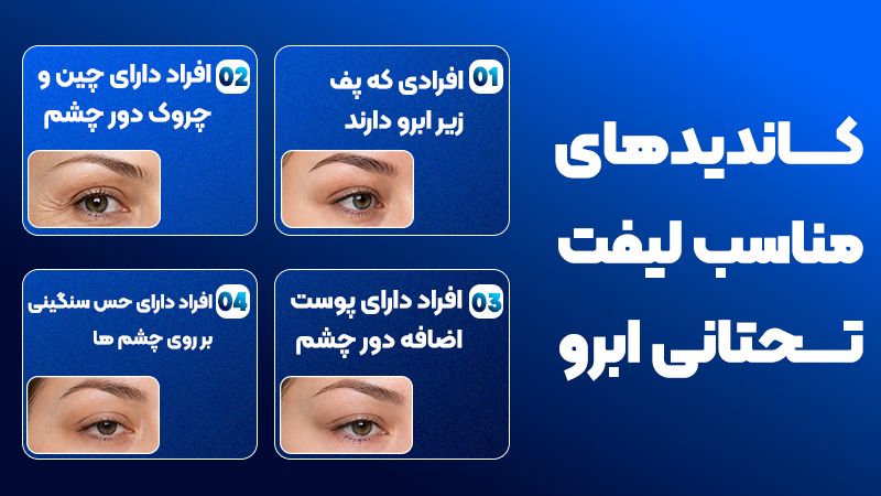 لیفت تحتانی ابرو برای بالا بردن ابرو مناسب است یا رفع پف ابرو؟ 2 کاندیدهای مناسب لیفت تحتانی ابرو