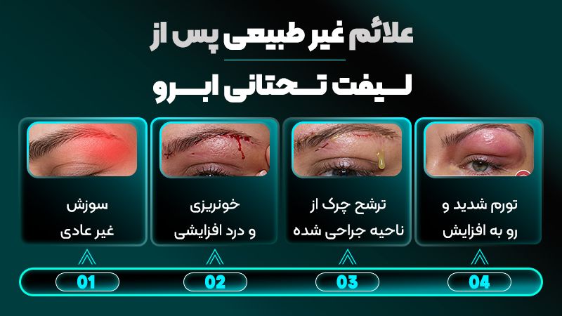 در پایان لیفت تحتانی ابرو محل برش چگونه پانسمان میشود؟ 2 علائم غیر طبیعی برش لیفت تحتانی ابرو