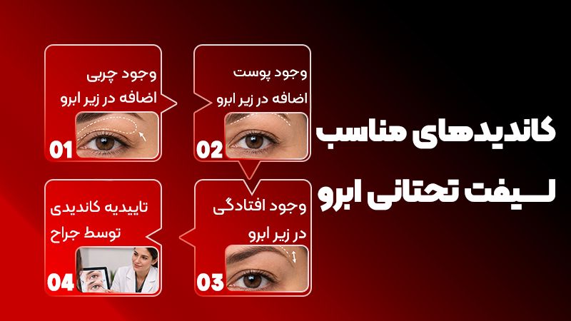 قبل از جراحی لیفت تحتانی ابرو چه چیزهایی را باید از جراح بپرسیم؟ 2 لیفت تحتانی ابرو انجام دهم یا بلفاروپلاستی؟