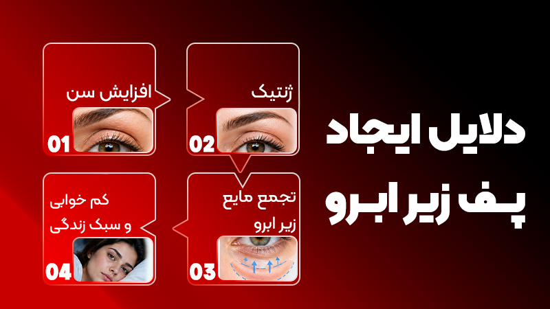 دلایل ایجاد پف زیر ابرو؛ راهکارهای دائمی رفع آن 1 مهمترین دلایل ایجاد پف زیر ابرو