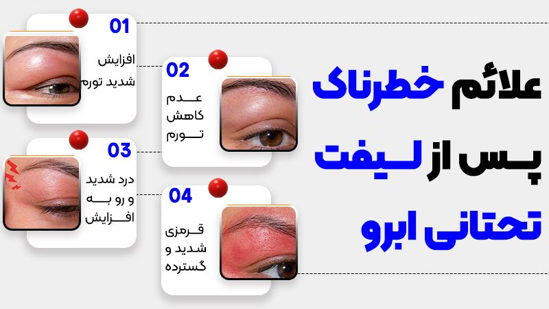 تورم بعد از لیفت تحتانی ابرو تا چه زمانی طبیعی است؟ 1 علائم همراه با تورم بعد از لیفت تحتانی ابرو و مراجعه به پزشک