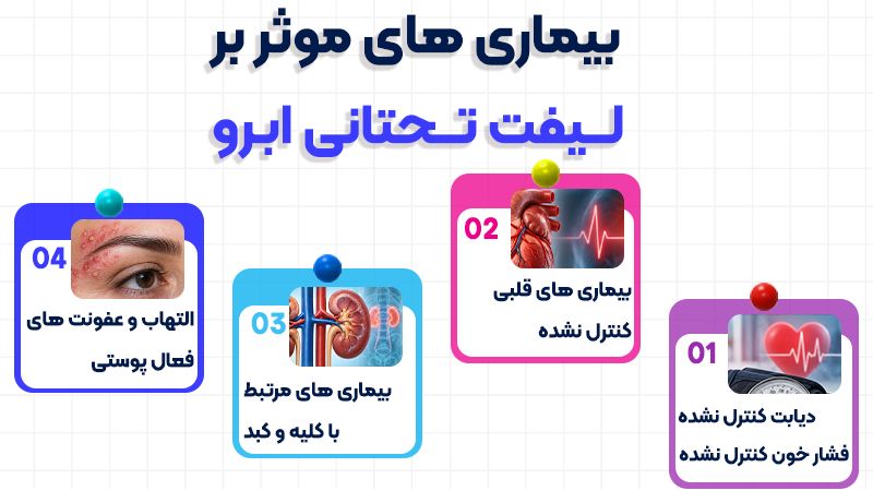 بیماریهایی که باعث عدم انجام لیفت تحتانی ابرو میشوند 1 بیماریهای موثر بر لیفت تحتانی ابرو