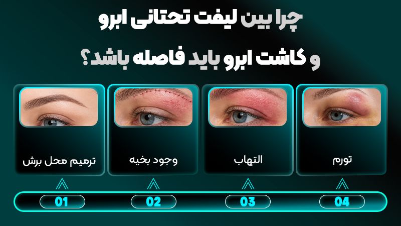 چه زمانی بعد از لیفت تحتانی ابرو میتوان ابرو کاشت؟ 2 چرا باید بین لیفت تحتانی ابرو و کاشت ابرو فاصله وجود داشته باشد؟