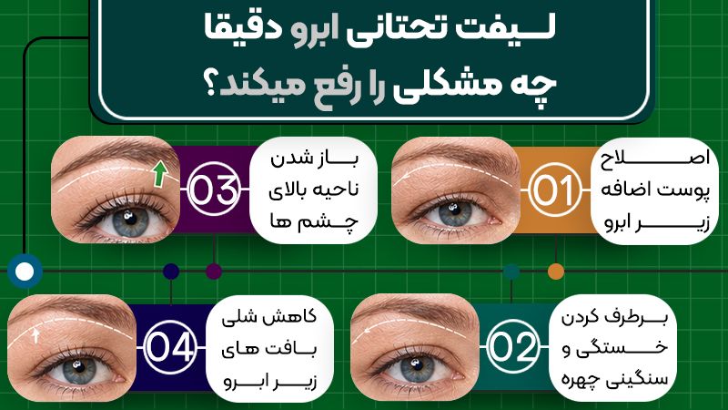 آیا لیفت تحتانی ابرو برای اصلاح فرم خود ابرو انجام میشود؟ 1 لیفت تحتانی ابرو دقیقا چه چالشی را رفع میکند؟
