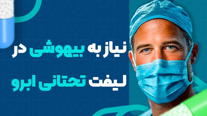 کاندیدهای مناسب لیفت تحتانی ابرو