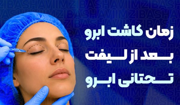 چه زمانی بعد از لیفت تحتانی ابرو می‌توان ابرو کاشت؟